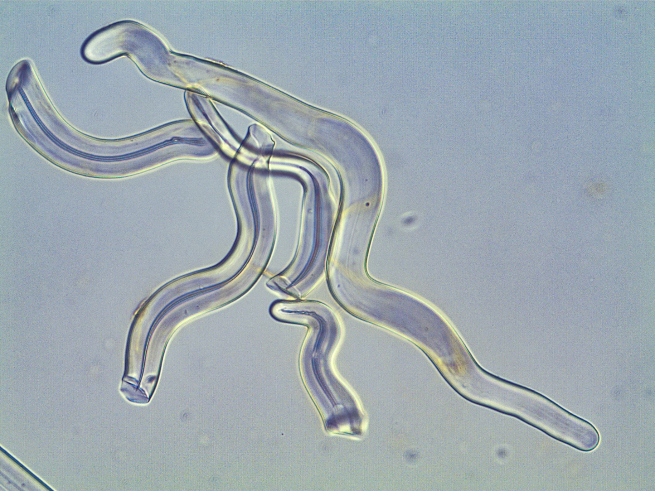 image: Bubaris vermiculata. Vermiform spicule.