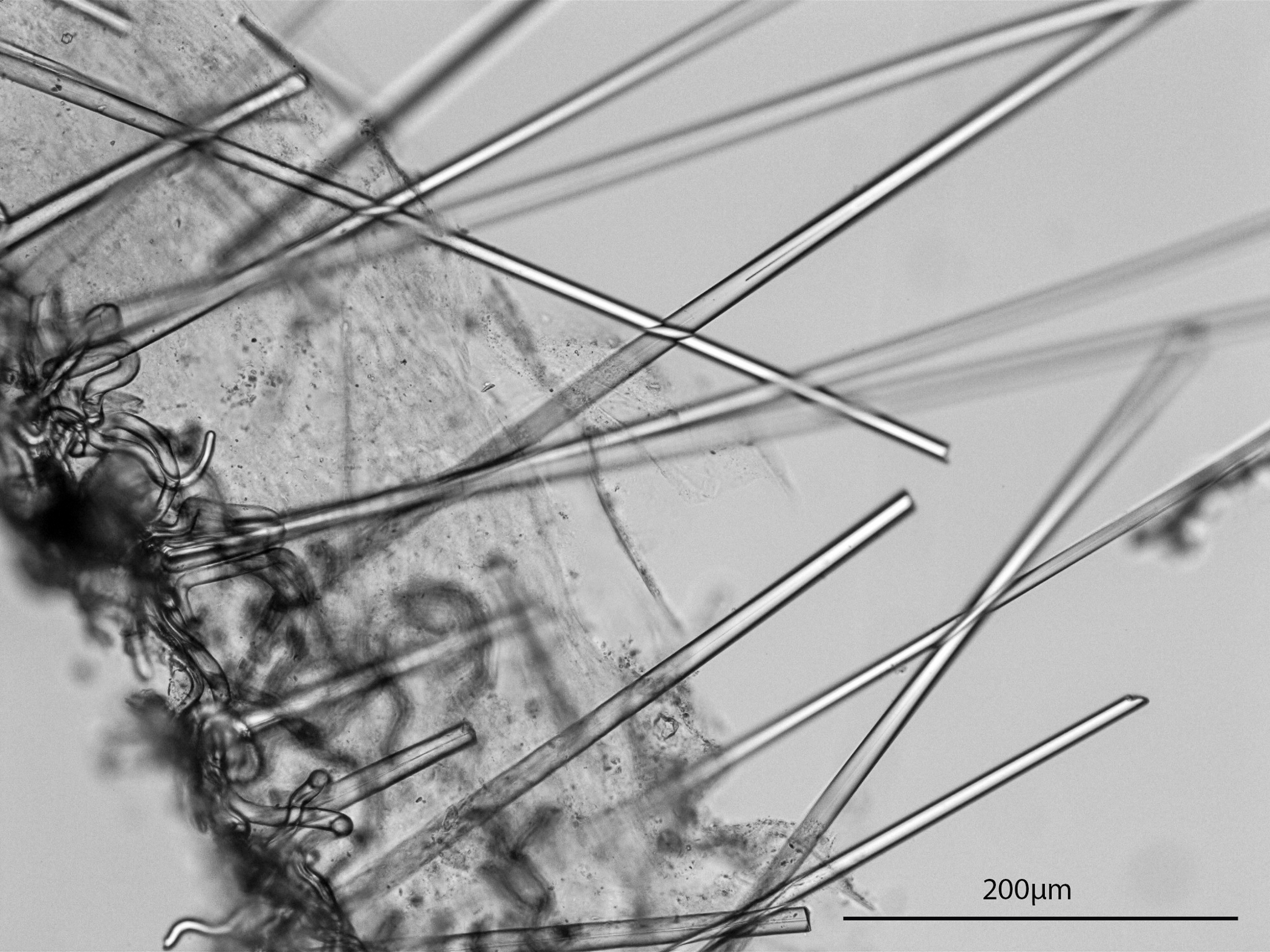 image: Bubaris vermiculata. Transverse section through sponge.